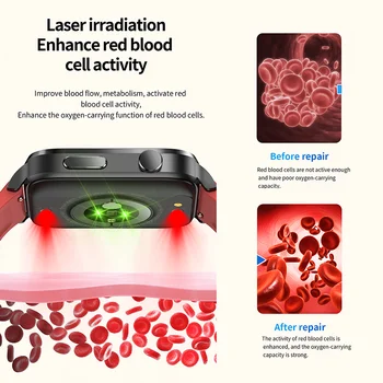 ZODVBOZ AMOLED Смарт Часовници Мъжки Лазерна Терапия Три Мониторинг на Високо Кръвно Налягане, IP68 Водоустойчив Умни Часовници За Xiaomi